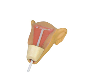 高级宫内避孕器训练模型
